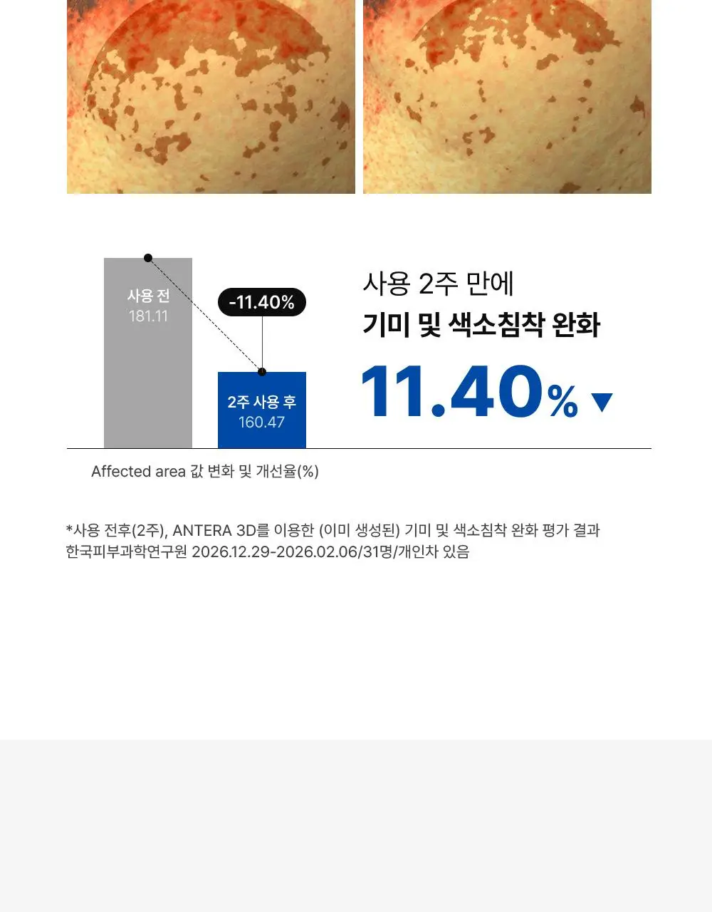 [단독기획] 동아제약 색소침착 프로 액제 30ml 기획(+크림제5ml) 상세페이지 15